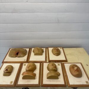 A- 352  Unusual Learning 3-Dimensional Models of Children Diseases, Deutsches Hygiene Museum Dresden Germany +- 1920